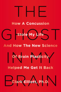 Concussion Story